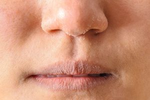 Lumeraskin | Kem dưỡng ẩm cho da khô – Bí quyết giữ làn da mềm mịn suốt 24h